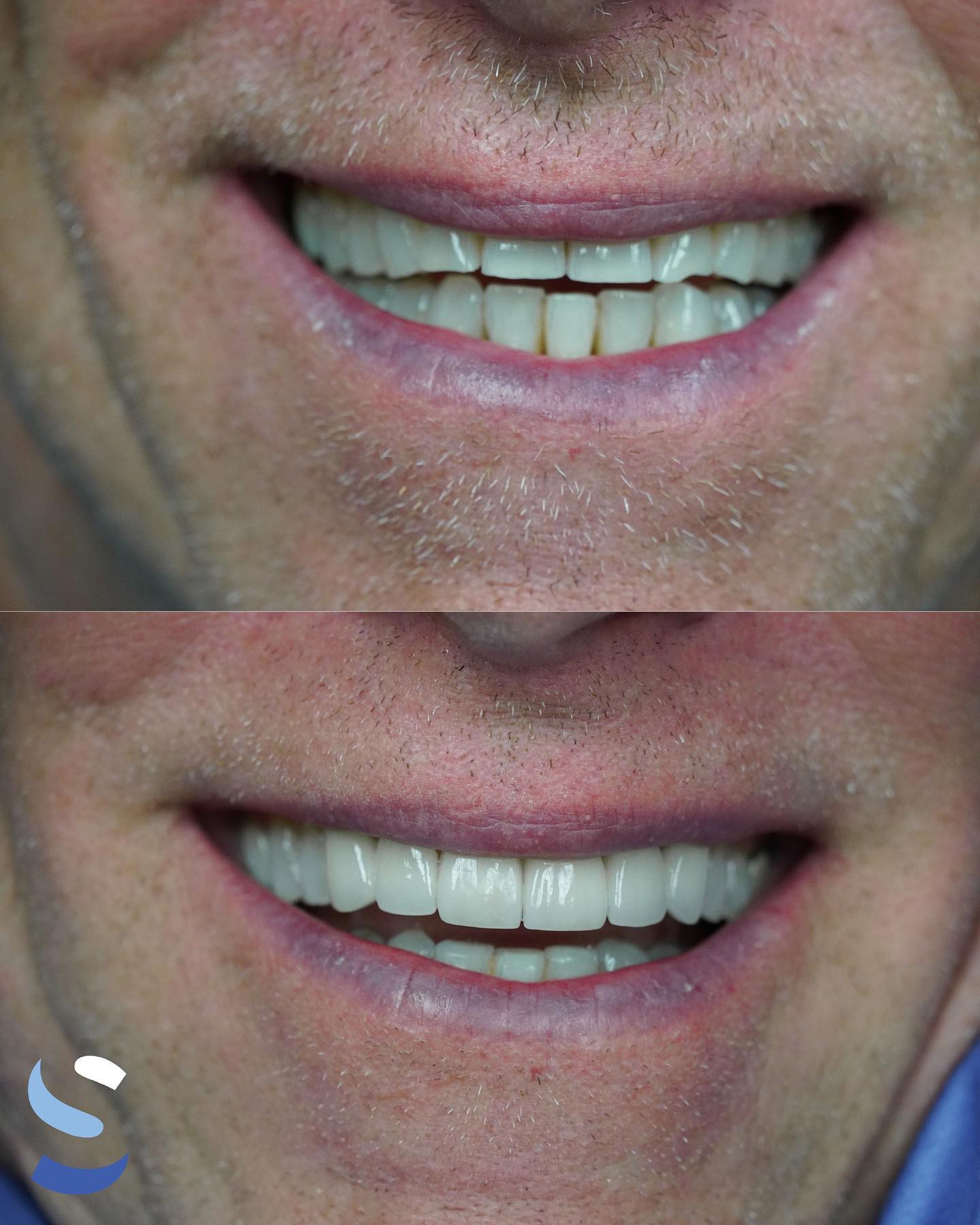 Before After Image